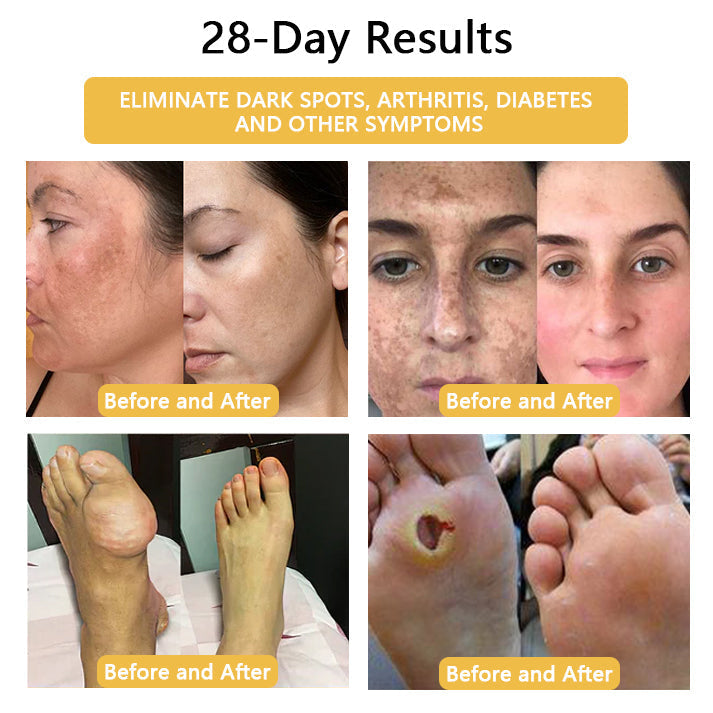 💥【BLACK FRIDAY SALE】80% OFF 🔥Histone™Lymphatic Activaty Earrings✨28-Day Results✨🔥