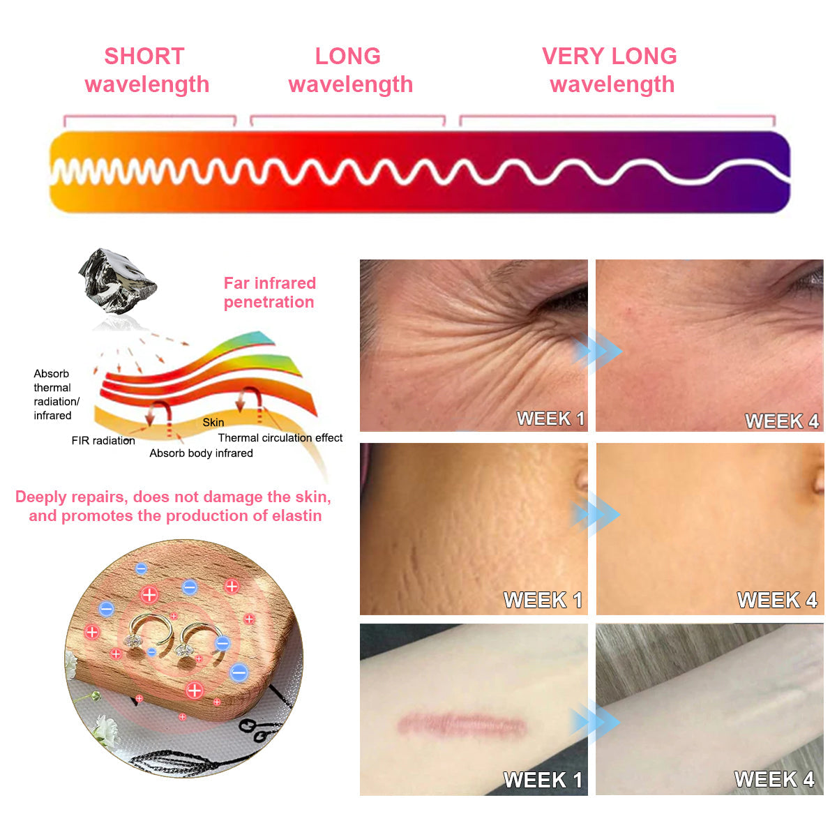 💥【BLACK FRIDAY SALE】80% OFF 🔥Histone™Lymphatic Activaty Earrings✨28-Day Results✨🔥