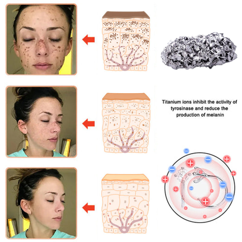 💥【BLACK FRIDAY SALE】80% OFF 🔥Histone™Lymphatic Activaty Earrings✨28-Day Results✨🔥